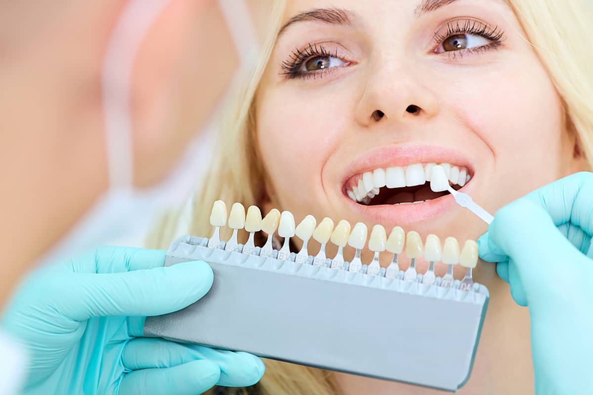 what to expect when getting porcelain veneers